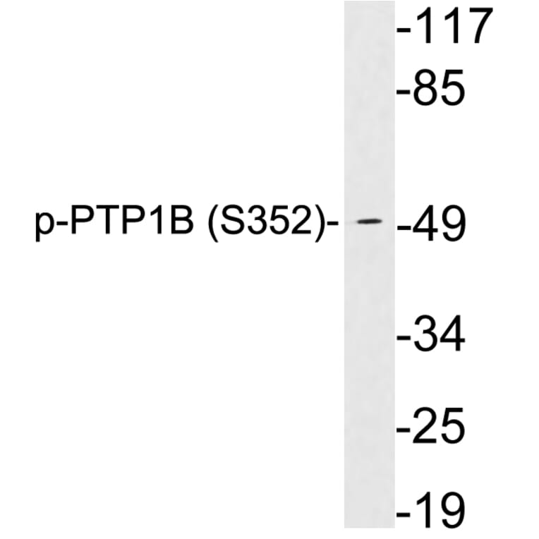 Western Blot - Anti-PTP1B (phospho Ser352) Antibody (P12-1052) - Antibodies.com