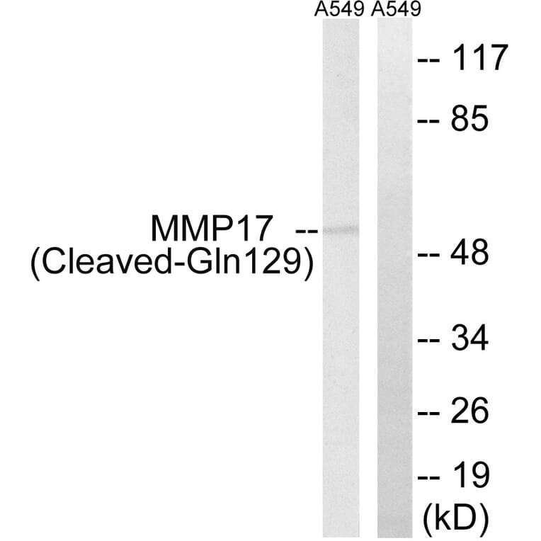 Western Blot - Anti-MMP17 (cleaved Gln129) Antibody (L0325) - Antibodies.com
