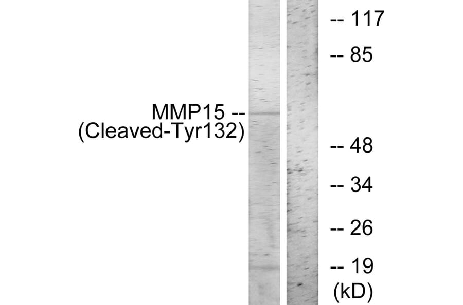 Western Blot - Anti-MMP15 (cleaved Tyr132) Antibody (L0323) - Antibodies.com