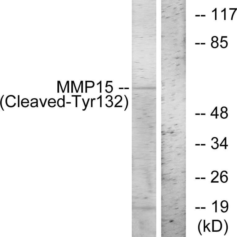 Western Blot - Anti-MMP15 (cleaved Tyr132) Antibody (L0323) - Antibodies.com
