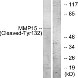 Western Blot - Anti-MMP15 (cleaved Tyr132) Antibody (L0323) - Antibodies.com