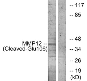 Western Blot - Anti-MMP12 (cleaved Glu106) Antibody (L0320) - Antibodies.com