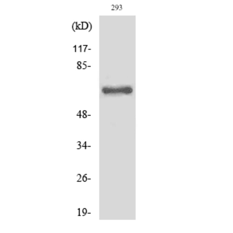 Western Blot - Anti-ITIH2 (cleaved Asp702) Antibody (L0300) - Antibodies.com
