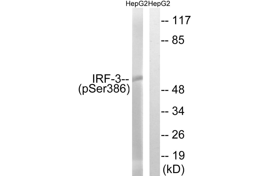 Western Blot - Anti-IRF-3 (phospho Ser386) Antibody (A8203) - Antibodies.com