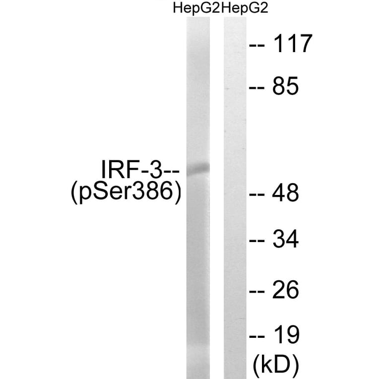 Western Blot - Anti-IRF-3 (phospho Ser386) Antibody (A8203) - Antibodies.com