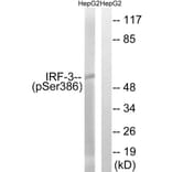 Western Blot - Anti-IRF-3 (phospho Ser386) Antibody (A8203) - Antibodies.com