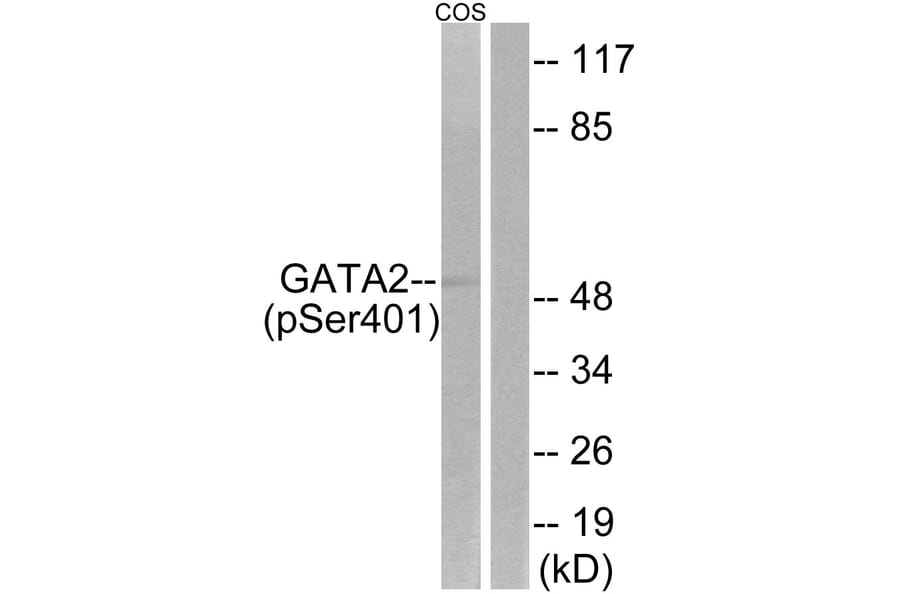 Western Blot - Anti-GATA2 (phospho Ser401) Antibody (A0932) - Antibodies.com