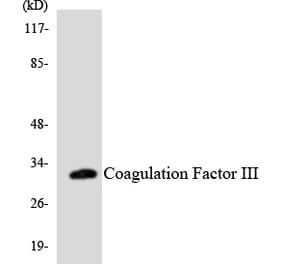 Western Blot - Anti-Coagulation Factor III Antibody (R12-2639) - Antibodies.com