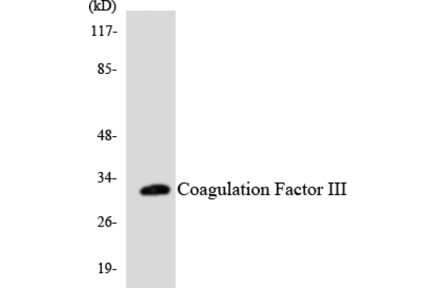 Western Blot - Anti-Coagulation Factor III Antibody (R12-2639) - Antibodies.com