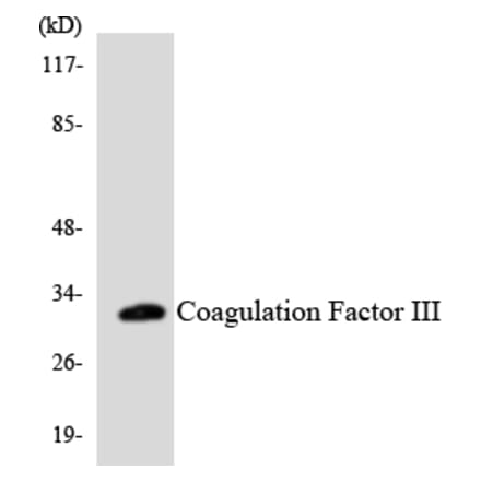 Western Blot - Anti-Coagulation Factor III Antibody (R12-2639) - Antibodies.com