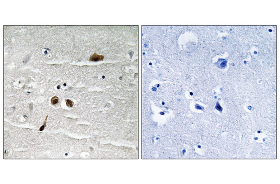 Immunohistochemistry - Anti-MDC1 (phospho Ser513) Antibody (A8368) - Antibodies.com