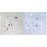 Immunohistochemistry - Anti-MDC1 (phospho Ser513) Antibody (A8368) - Antibodies.com