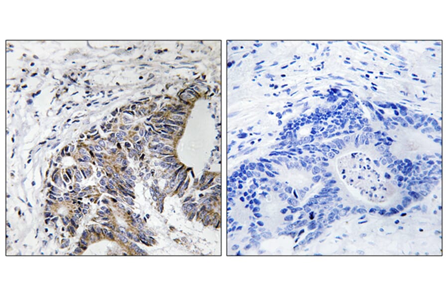 Immunohistochemistry - Anti-FHIT (phospho Tyr114) Antibody (A8459) - Antibodies.com