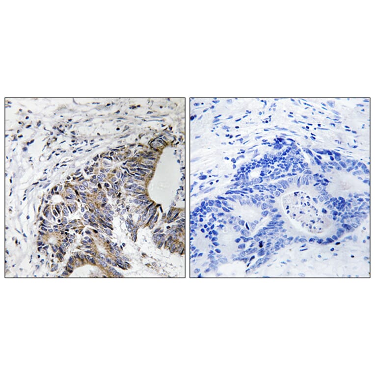Immunohistochemistry - Anti-FHIT (phospho Tyr114) Antibody (A8459) - Antibodies.com
