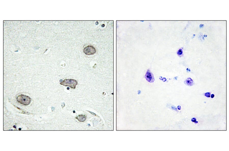 Immunohistochemistry - Anti-CSFR (phospho Tyr809) Antibody (A0876) - Antibodies.com