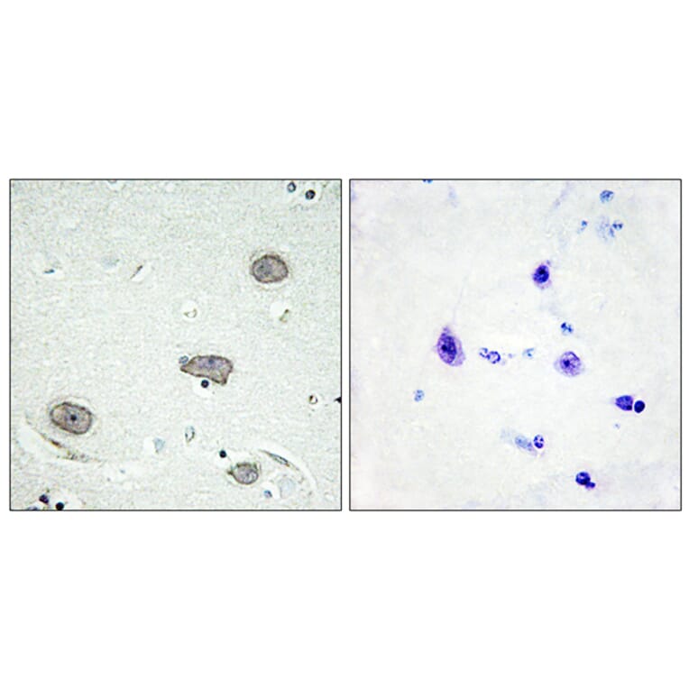 Immunohistochemistry - Anti-CSFR (phospho Tyr809) Antibody (A0876) - Antibodies.com