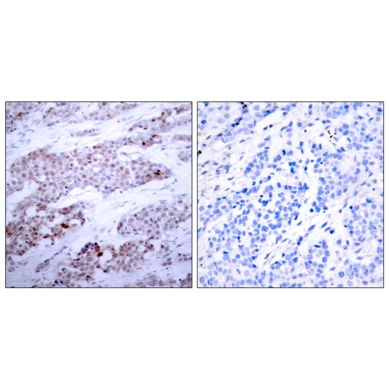 Immunohistochemistry - Anti-ATF4 (phospho Ser245) Antibody (A7017) - Antibodies.com