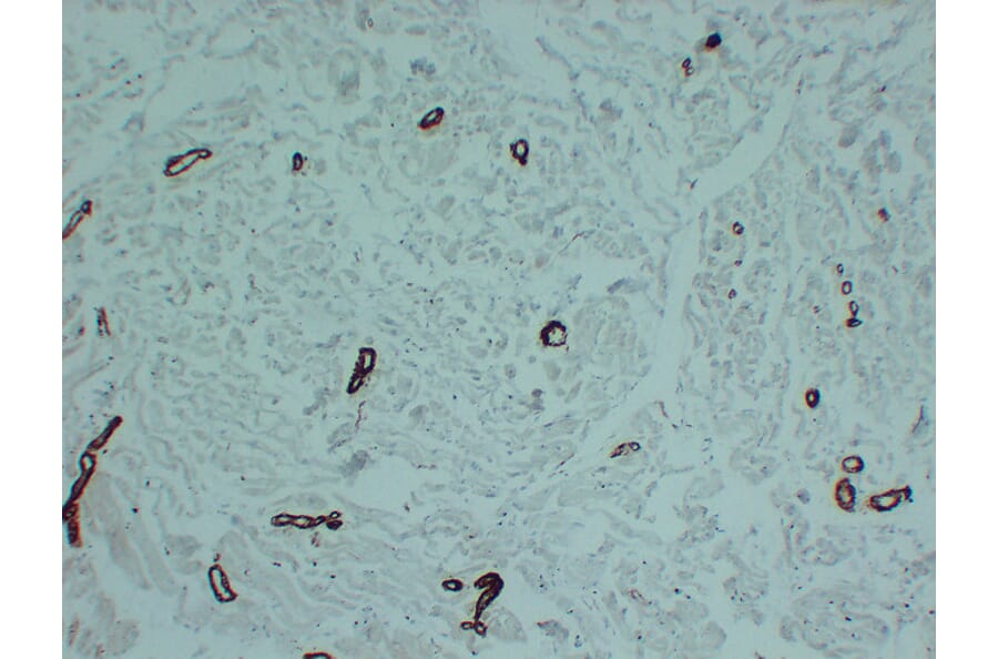 Immunohistochemistry - Anti-smooth muscle Actin Antibody (V0004) - Antibodies.com