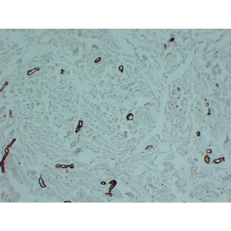 Immunohistochemistry - Anti-smooth muscle Actin Antibody (V0004) - Antibodies.com