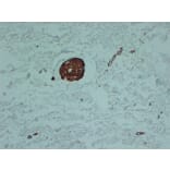 Immunohistochemistry - Anti-smooth muscle Actin Antibody (V0004) - Antibodies.com