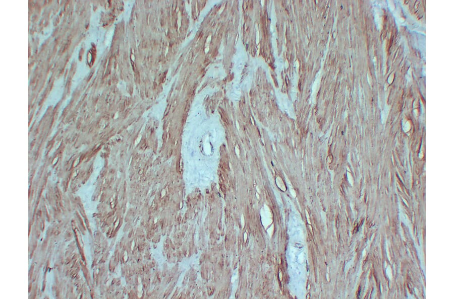 Immunohistochemistry - Anti-smooth muscle Actin Antibody (V0004) - Antibodies.com