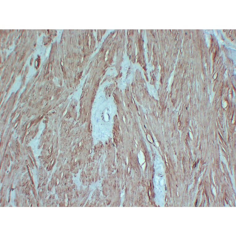 Immunohistochemistry - Anti-smooth muscle Actin Antibody (V0004) - Antibodies.com