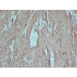 Immunohistochemistry - Anti-smooth muscle Actin Antibody (V0004) - Antibodies.com