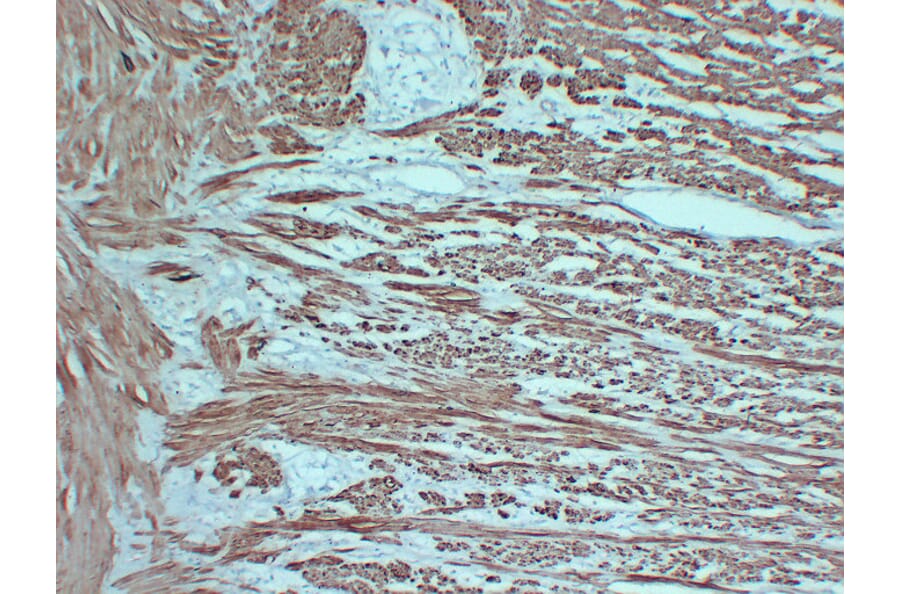 Immunohistochemistry - Anti-smooth muscle Actin Antibody (V0004) - Antibodies.com