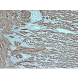 Immunohistochemistry - Anti-smooth muscle Actin Antibody (V0004) - Antibodies.com