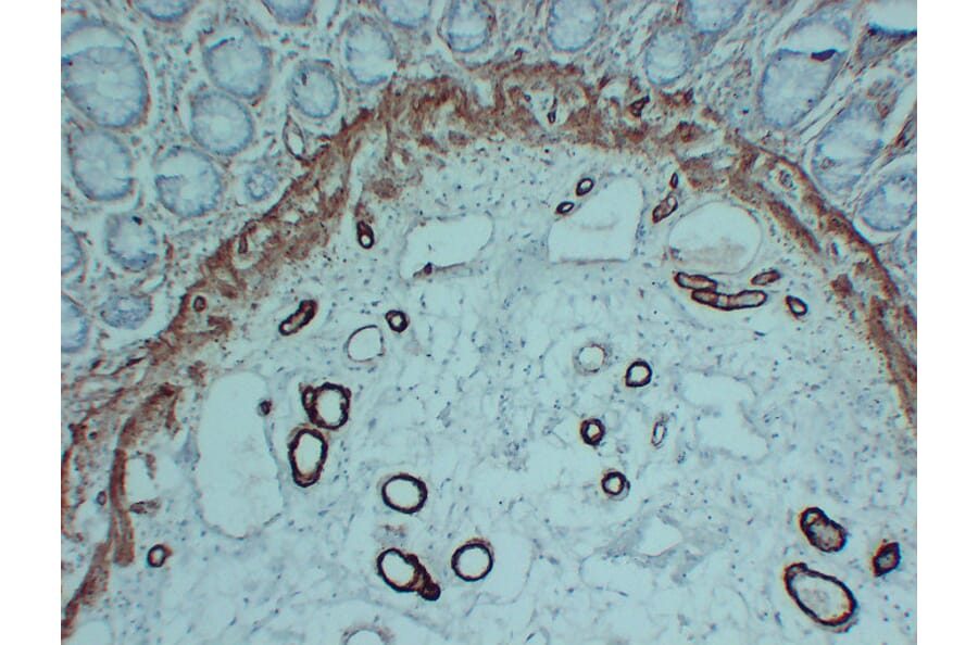 Immunohistochemistry - Anti-smooth muscle Actin Antibody (V0004) - Antibodies.com
