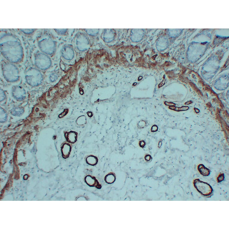 Immunohistochemistry - Anti-smooth muscle Actin Antibody (V0004) - Antibodies.com