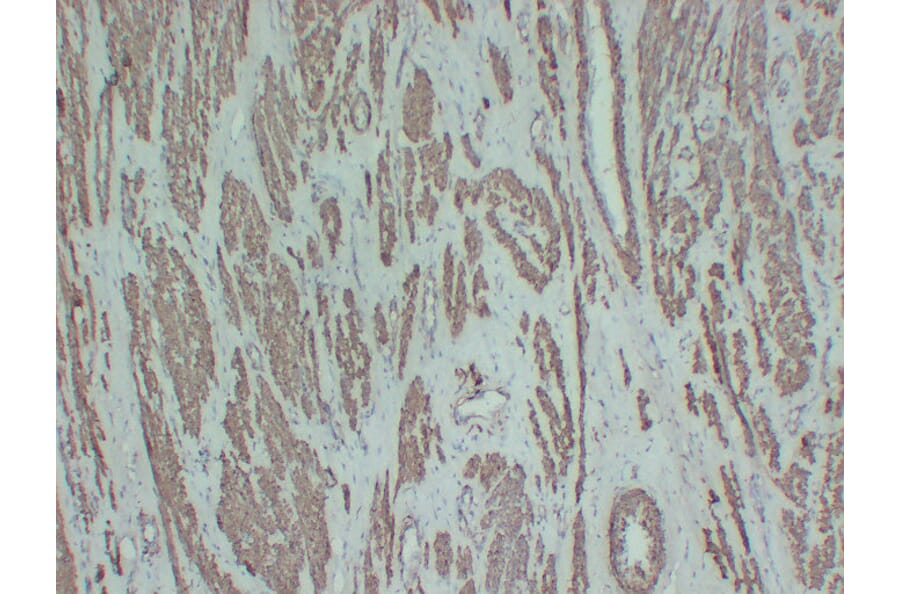 Immunohistochemistry - Anti-smooth muscle Actin Antibody (V0004) - Antibodies.com