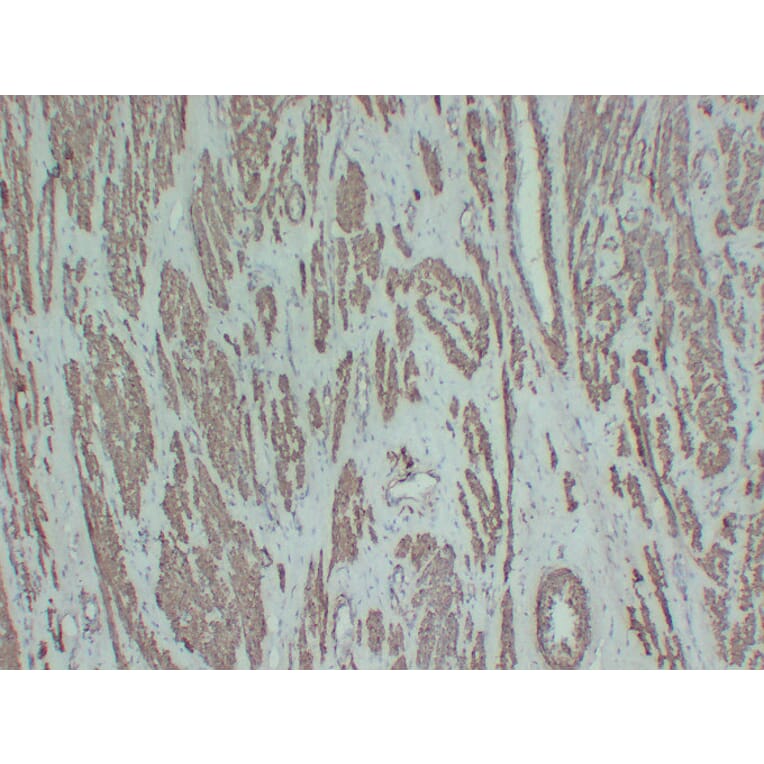 Immunohistochemistry - Anti-smooth muscle Actin Antibody (V0004) - Antibodies.com