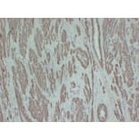 Immunohistochemistry - Anti-smooth muscle Actin Antibody (V0004) - Antibodies.com