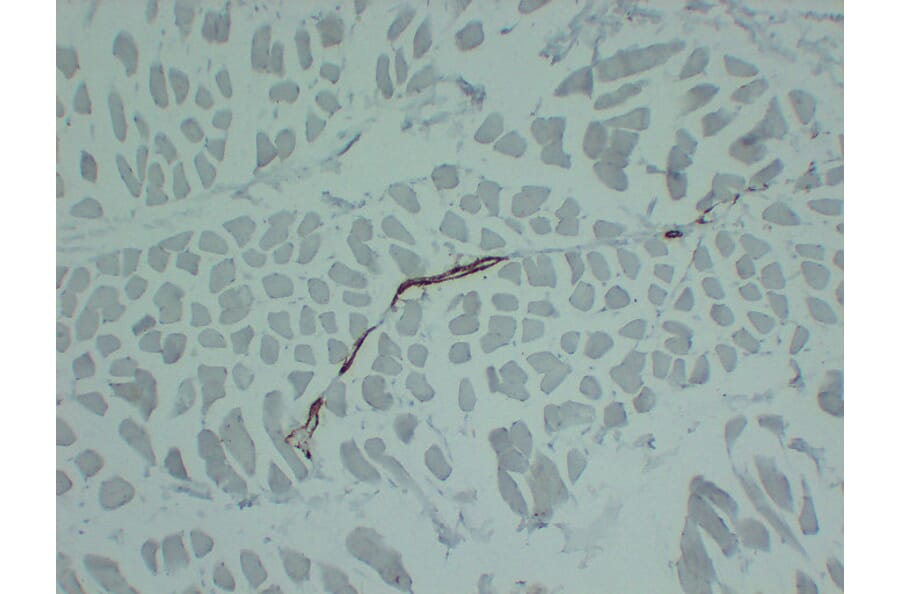Immunohistochemistry - Anti-smooth muscle Actin Antibody (V0004) - Antibodies.com
