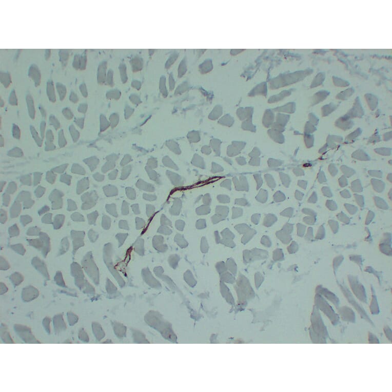 Immunohistochemistry - Anti-smooth muscle Actin Antibody (V0004) - Antibodies.com