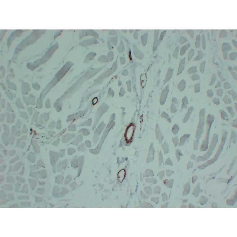 Immunohistochemistry - Anti-smooth muscle Actin Antibody (V0004) - Antibodies.com