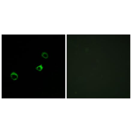 Immunofluorescence - Anti-Cytochrome b561 D1 Antibody (C12081) - Antibodies.com
