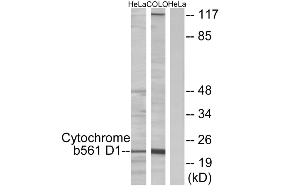 Western Blot - Anti-Cytochrome b561 D1 Antibody (C12081) - Antibodies.com