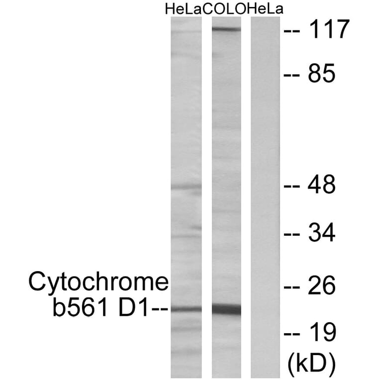 Western Blot - Anti-Cytochrome b561 D1 Antibody (C12081) - Antibodies.com