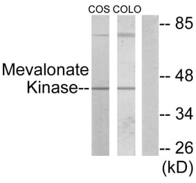 Western Blot - Anti-Mevalonate Kinase Antibody (C10868) - Antibodies.com