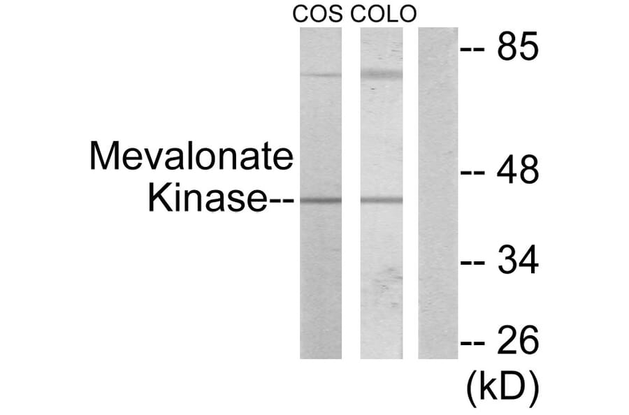 Western Blot - Anti-Mevalonate Kinase Antibody (C10868) - Antibodies.com