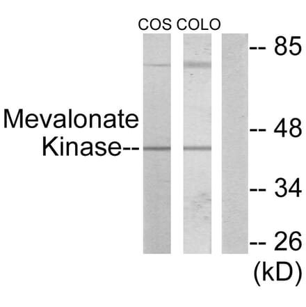 Western Blot - Anti-Mevalonate Kinase Antibody (C10868) - Antibodies.com