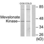 Western Blot - Anti-Mevalonate Kinase Antibody (C10868) - Antibodies.com