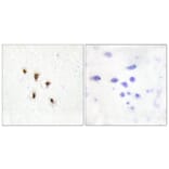 Immunohistochemistry - Anti-Mevalonate Kinase Antibody (C10868) - Antibodies.com