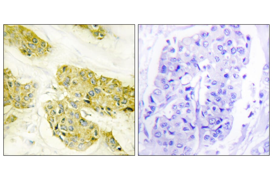 Immunohistochemistry - Anti-Collagen V alpha3 Antibody (C12203) - Antibodies.com