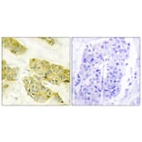 Immunohistochemistry - Anti-Collagen V alpha3 Antibody (C12203) - Antibodies.com