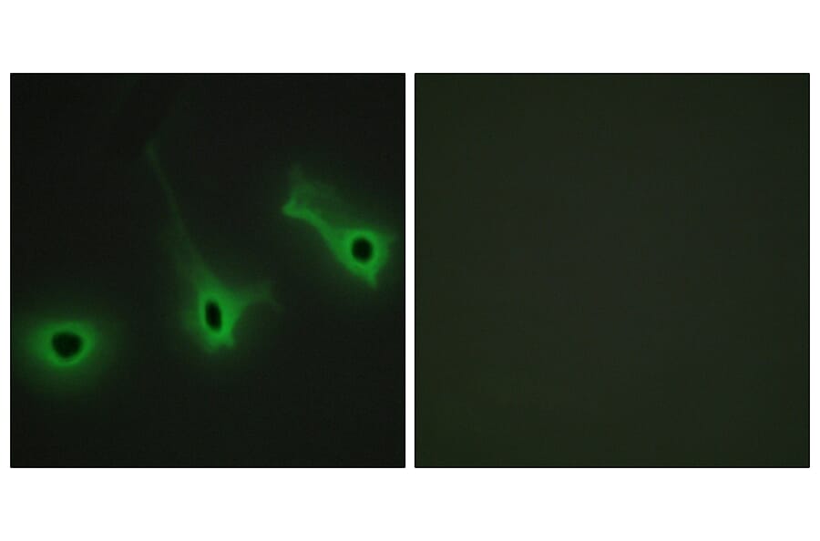 Immunofluorescence - Anti-Collagen V alpha3 Antibody (C12203) - Antibodies.com
