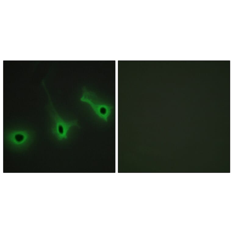 Immunofluorescence - Anti-Collagen V alpha3 Antibody (C12203) - Antibodies.com