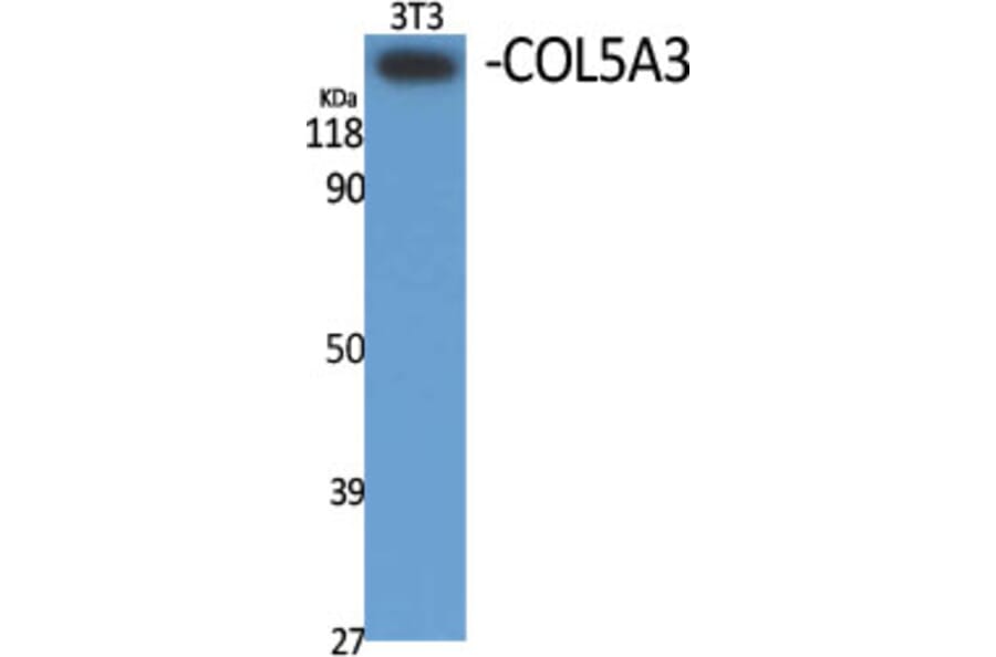 Western Blot - Anti-Collagen V alpha3 Antibody (C12203) - Antibodies.com